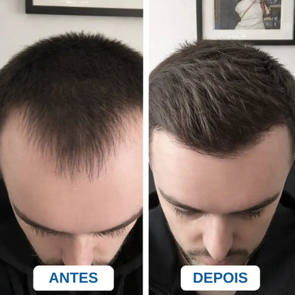 Vellus Sérum de Crescimento
